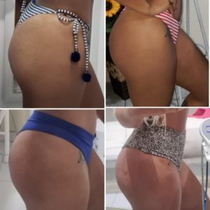 Antes-e-depois-10-300x300-1-300x300